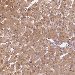 Invitrogen NAPRT1 Monoclonal Antibody (CL0366) 100 &mu;L; Unconjugated:Antibodies,