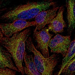 Invitrogen PLA2R1 Monoclonal Antibody (CL0474) 100 &mu;L; Unconjugated:Antibodies,