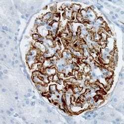 Invitrogen PLA2R1 Monoclonal Antibody (CL0474) 100 &mu;L; Unconjugated:Antibodies,