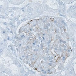 Invitrogen PLA2R1 Monoclonal Antibody (CL0474) 100 &mu;L; Unconjugated:Antibodies,