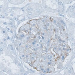 Invitrogen PLA2R1 Monoclonal Antibody (CL0474) 100 &mu;L; Unconjugated:Antibodies,