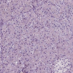 Invitrogen PLA2R1 Monoclonal Antibody (CL0485) 100 &mu;L; Unconjugated:Antibodies,