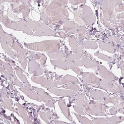 Invitrogen PLA2R1 Monoclonal Antibody (CL0485) 100 &mu;L; Unconjugated:Antibodies,