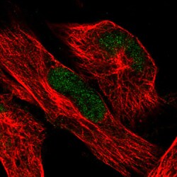 Invitrogen ATRX Monoclonal Antibody (CL0537) 100 &mu;L; Unconjugated:Antibodies,