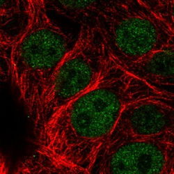 Invitrogen ATRX Monoclonal Antibody (CL0537) 100 &mu;L; Unconjugated:Antibodies,