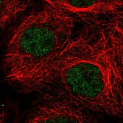 Invitrogen ATRX Monoclonal Antibody (CL0537) 100 &mu;L; Unconjugated:Antibodies,