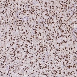 Invitrogen ATRX Monoclonal Antibody (CL0537) 100 &mu;L; Unconjugated:Antibodies,