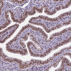 Invitrogen ATRX Monoclonal Antibody (CL0537) 100 &mu;L; Unconjugated:Antibodies,