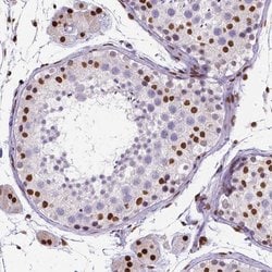 Invitrogen ATRX Monoclonal Antibody (CL0537) 100 &mu;L; Unconjugated:Antibodies,
