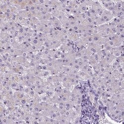 Invitrogen ATRX Monoclonal Antibody (CL0537) 100 &mu;L; Unconjugated:Antibodies,