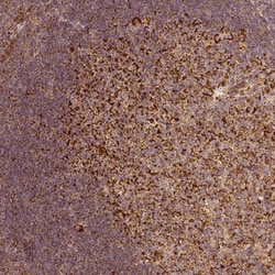 Invitrogen PGAM5 Monoclonal Antibody (CL0624) 100 &mu;L; Unconjugated:Antibodies,