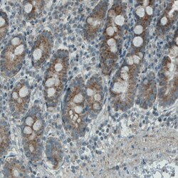 Invitrogen PGAM5 Monoclonal Antibody (CL0624) 100 &mu;L; Unconjugated:Antibodies,
