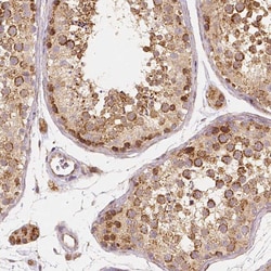 Invitrogen PGAM5 Monoclonal Antibody (CL0624) 100 &mu;L; Unconjugated:Antibodies,