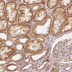 Invitrogen PGAM5 Monoclonal Antibody (CL0624) 100 &mu;L; Unconjugated:Antibodies,