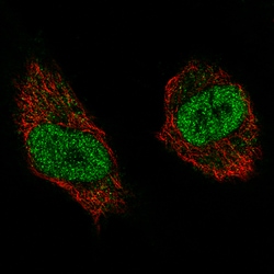 Invitrogen NSD2 Monoclonal Antibody (CL1063) 100 &mu;L; Unconjugated:Antibodies,