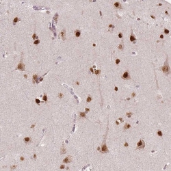Invitrogen NSD2 Monoclonal Antibody (CL1063) 100 &mu;L; Unconjugated:Antibodies,