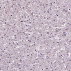 Invitrogen NSD2 Monoclonal Antibody (CL1063) 100 &mu;L; Unconjugated:Antibodies,