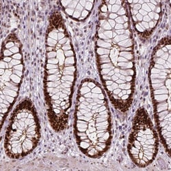 Invitrogen NSD2 Monoclonal Antibody (CL1063) 100 &mu;L; Unconjugated:Antibodies,
