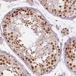 Invitrogen NSD2 Monoclonal Antibody (CL1063) 100 &mu;L; Unconjugated:Antibodies,