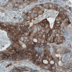 Invitrogen DIAPH2 Monoclonal Antibody (CL1113) 100 &mu;L; Unconjugated:Antibodies,