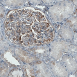 Invitrogen DIAPH2 Monoclonal Antibody (CL1113) 100 &mu;L; Unconjugated:Antibodies,