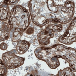 Invitrogen DIAPH2 Monoclonal Antibody (CL1113) 100 &mu;L; Unconjugated:Antibodies,