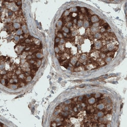 Invitrogen DIAPH2 Monoclonal Antibody (CL1113) 100 &mu;L; Unconjugated:Antibodies,