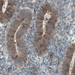 Invitrogen DIAPH2 Monoclonal Antibody (CL1113) 100 &mu;L; Unconjugated:Antibodies,