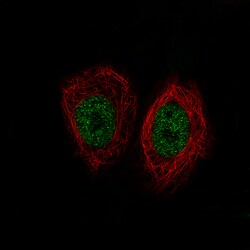 Invitrogen KDM5B Monoclonal Antibody (CL1129) 100 &mu;L; Unconjugated:Antibodies,