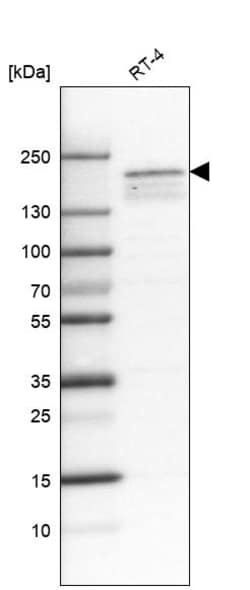 Invitrogen KDM5B Monoclonal Antibody (CL1147) 100 &mu;L; Unconjugated:Antistoffer