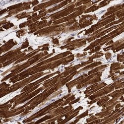 Invitrogen MYH6 Monoclonal Antibody (CL2162) 100 &mu;L; Unconjugated:Antibodies,