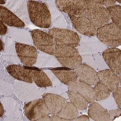 Invitrogen MYH6 Monoclonal Antibody (CL2162) 100 &mu;L; Unconjugated:Antibodies,
