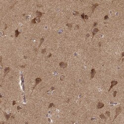Invitrogen CARS Monoclonal Antibody (CL2309) 100 &mu;L; Unconjugated:Antibodies,