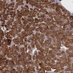 Invitrogen CARS Monoclonal Antibody (CL2309) 100 &mu;L; Unconjugated:Antibodies,