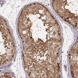 Invitrogen CARS Monoclonal Antibody (CL2309) 100 &mu;L; Unconjugated:Antibodies,