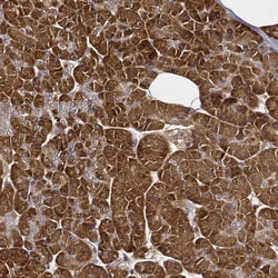 Invitrogen CARS Monoclonal Antibody (CL2310) 100 &mu;L; Unconjugated:Antibodies,