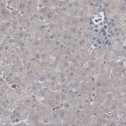Invitrogen LY6K Monoclonal Antibody (CL2435) 100 &mu;L; Unconjugated:Antibodies,