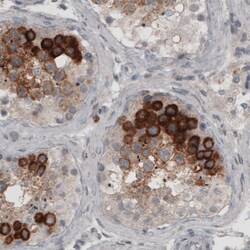 Invitrogen LY6K Monoclonal Antibody (CL2435) 100 &mu;L; Unconjugated:Antibodies,