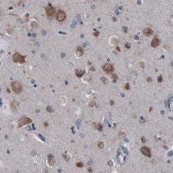 Invitrogen GRASP55 Monoclonal Antibody (CL2522) 100 &mu;L; Unconjugated:Antibodies,