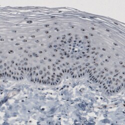 Invitrogen NOP56 Monoclonal Antibody (CL2603) 100 &mu;L | Buy Online | Invitrogen&trade; | Fisher Scientific