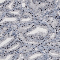 Invitrogen NOP56 Monoclonal Antibody (CL2603) 100 &mu;L | Buy Online | Invitrogen&trade; | Fisher Scientific