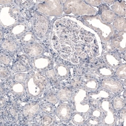 Invitrogen Norepinephrine Transporter Monoclonal Antibody (CL3063) 100