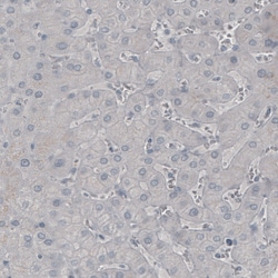 Invitrogen SSX2 Monoclonal Antibody (CL3202) 100 &mu;L; Unconjugated:Antibodies,
