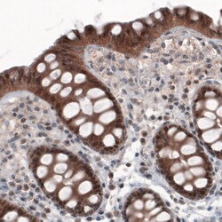 Invitrogen PGM1 Monoclonal Antibody (CL3299) 100 &mu;L; Unconjugated:Antibodies,
