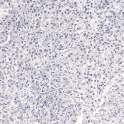Invitrogen Laminin beta-3 Monoclonal Antibody (CL3353) 100 &mu;L; Unconjugated:Antibodies,