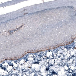 Invitrogen Laminin beta-3 Monoclonal Antibody (CL3353) 100 &mu;L; Unconjugated:Antibodies,