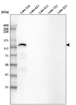 Invitrogen Laminin beta-3 Monoclonal Antibody (CL3353) 100 &mu;L; Unconjugated:Antibodies,