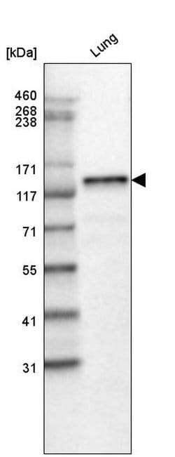 Invitrogen Laminin beta-3 Monoclonal Antibody (CL3353) 100 &mu;L; Unconjugated:Antibodies,