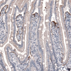 Invitrogen Laminin beta-3 Monoclonal Antibody (CL3363) 100 &mu;L; Unconjugated:Antikroppar