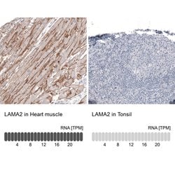Invitrogen Laminin alpha-2 Monoclonal Antibody (CL3450) 100 &mu;L; Unconjugated:Antibodies,